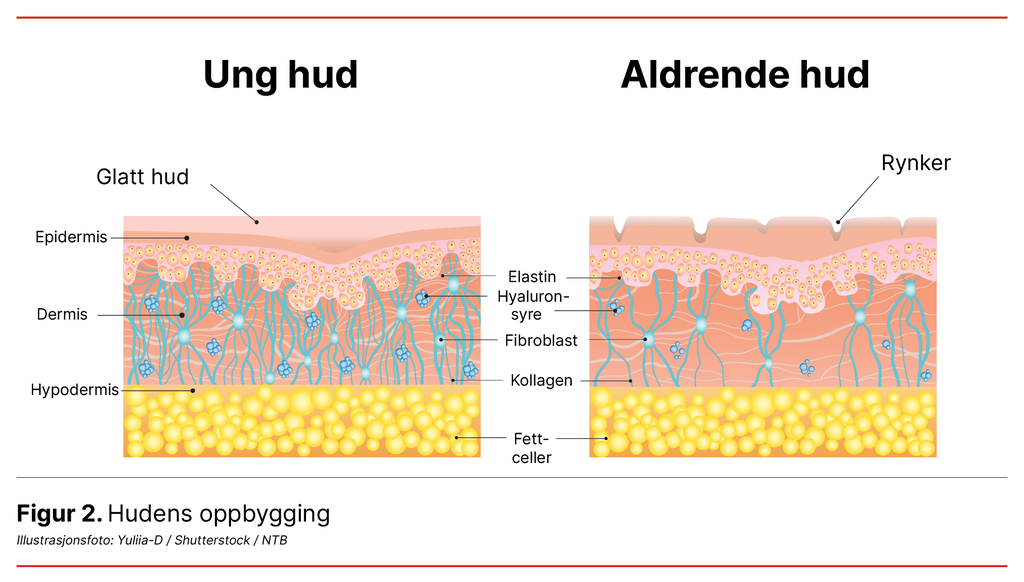 Figur 2. Hudens oppbygging