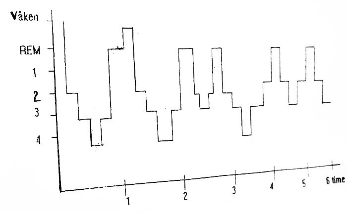 Bilde viser søvnfrekvens