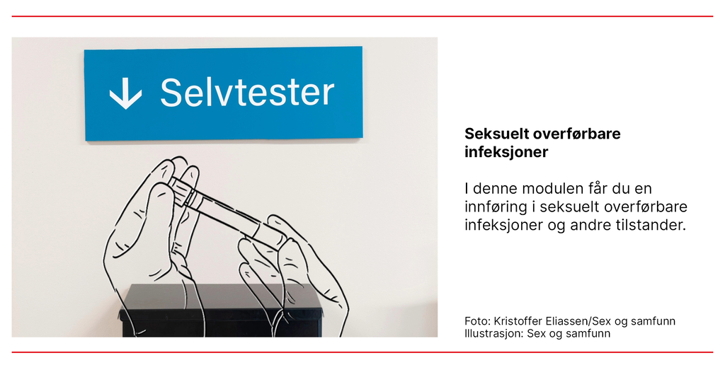 Bildet viser en illustrasjon av seksuelt overførbare infeksjoner