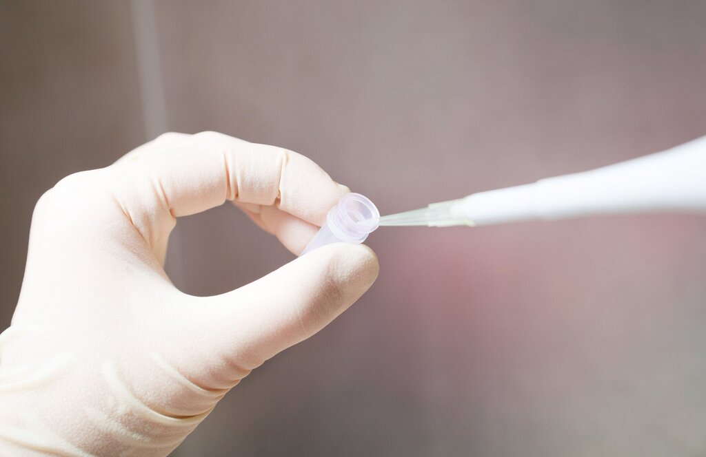 Bilde fra laboratori hvor en prøve skal analyseres