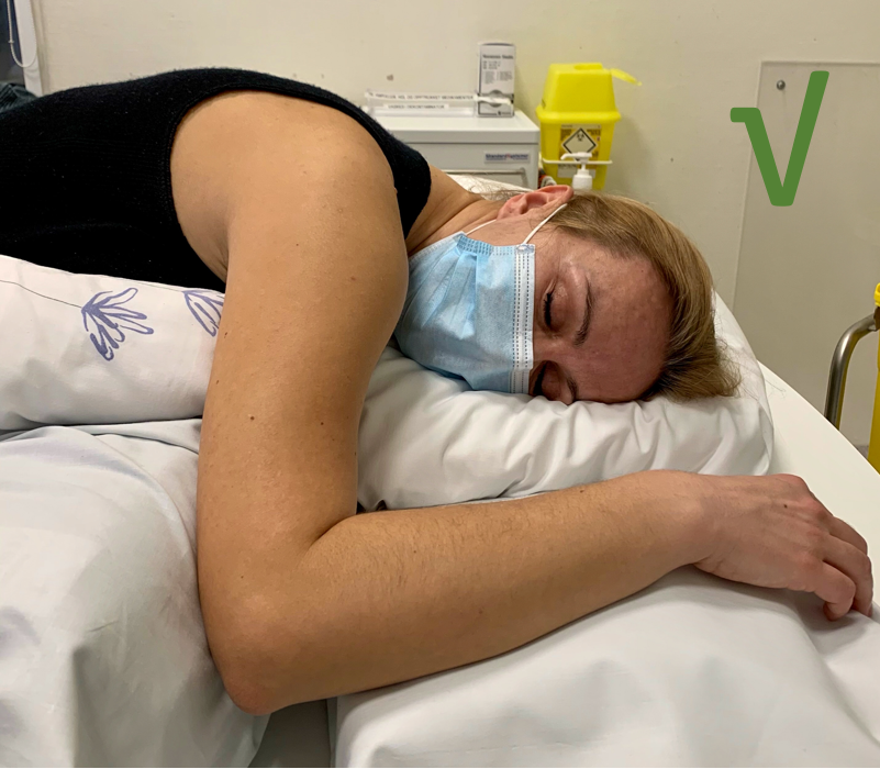 Bilde 3. Eksempel på leiring for å forebygge&nbsp;plexus brachialis- og nervus ulnaris-skade.