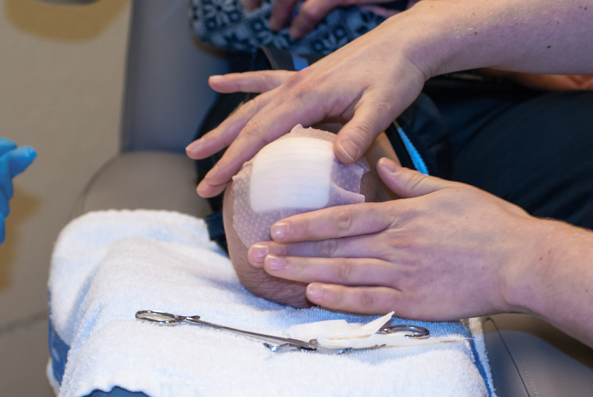 Stell og sjekk av beinstump etter amputasjon.