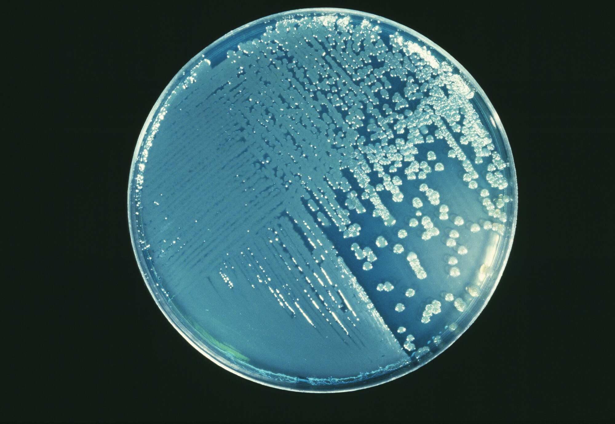 Pseudomonas aeruginosa, petriskål Bildet viser en petriskål med Pseudomonas aeruginosa.