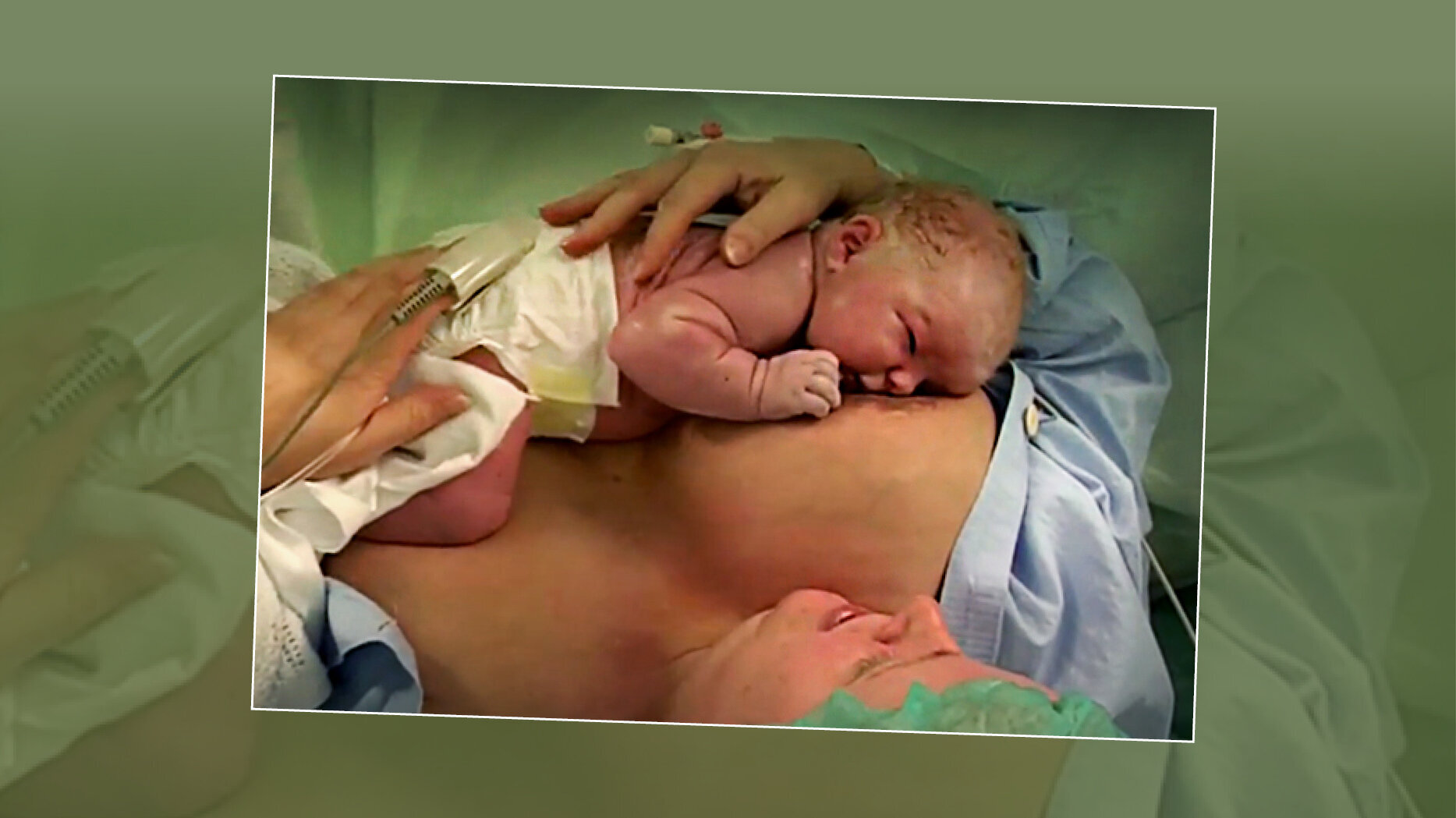 Bildet viser en nyfødt baby som ligger på brystet til moren og ammes