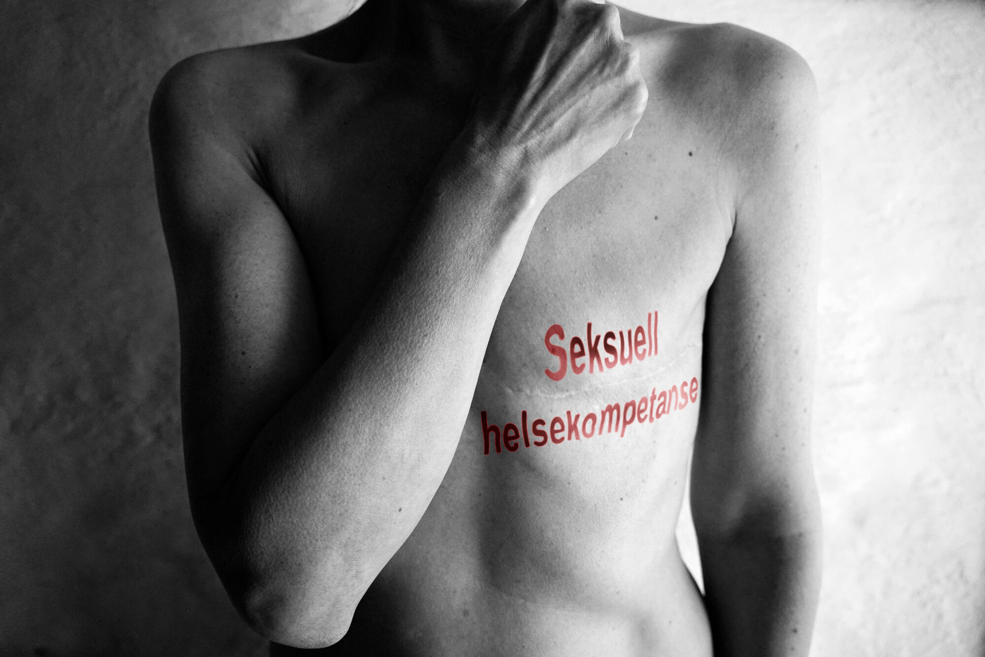 Bildet viser en kvinne som har fått fjernet et bryst.