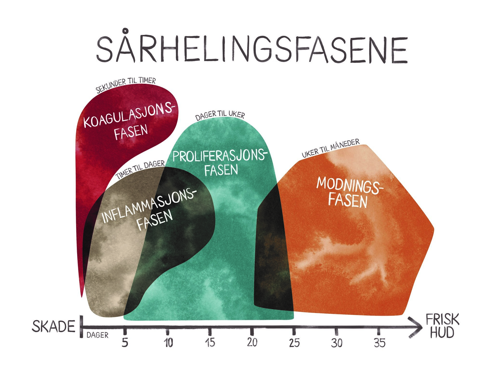 Illustrasjonen viser de fire sårhelingsfasene.