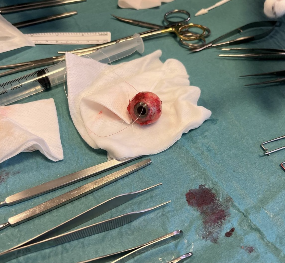 Bildet viser et øye.