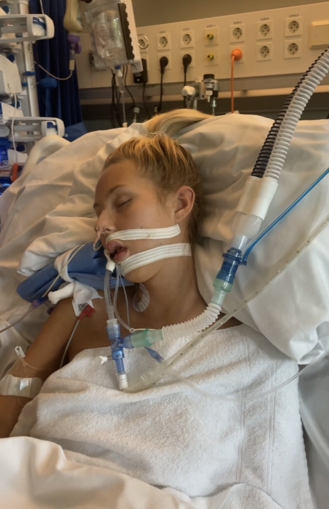 Bekkevar på sykehuset. Hun ligger i en sykehusseng. 