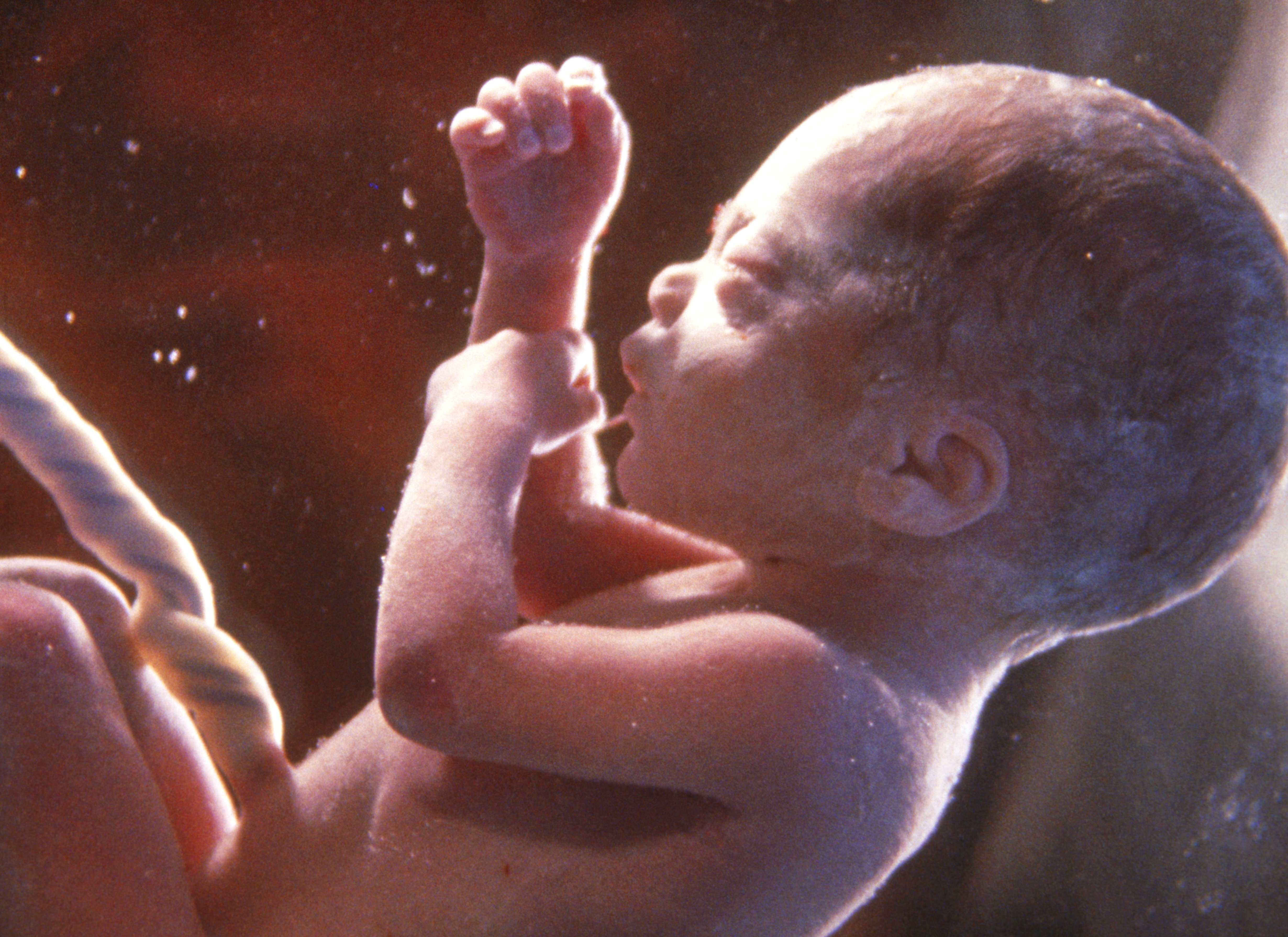 Bildet viser et foster med navlesnor.