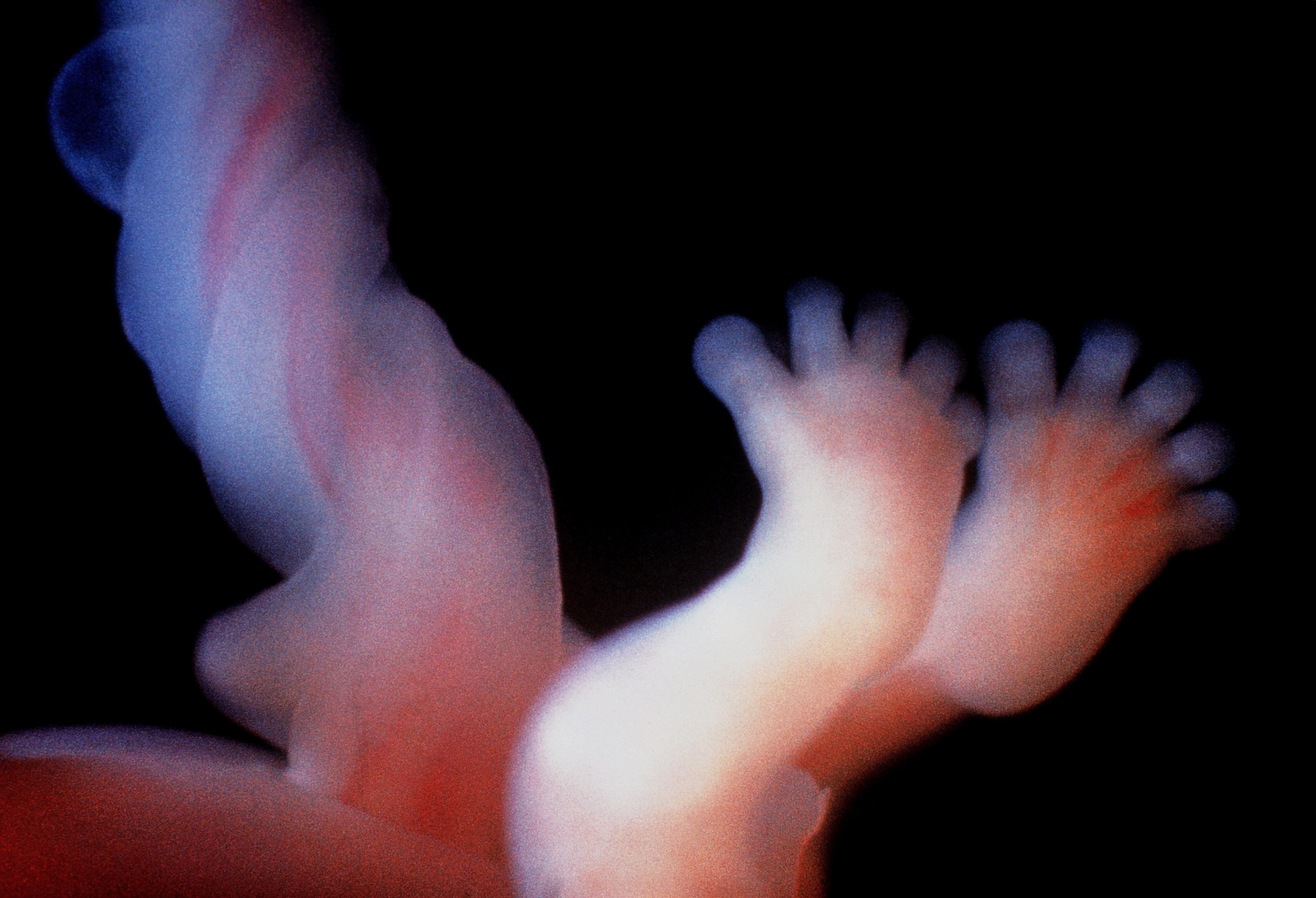 Bildet viser foster med navlesnor.