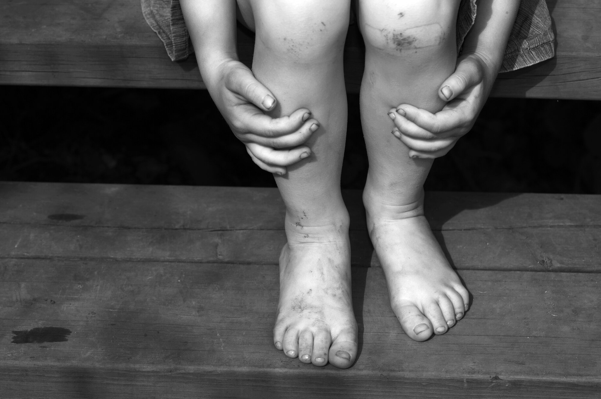 Illustrasjonsbilde av barn som er skadet.