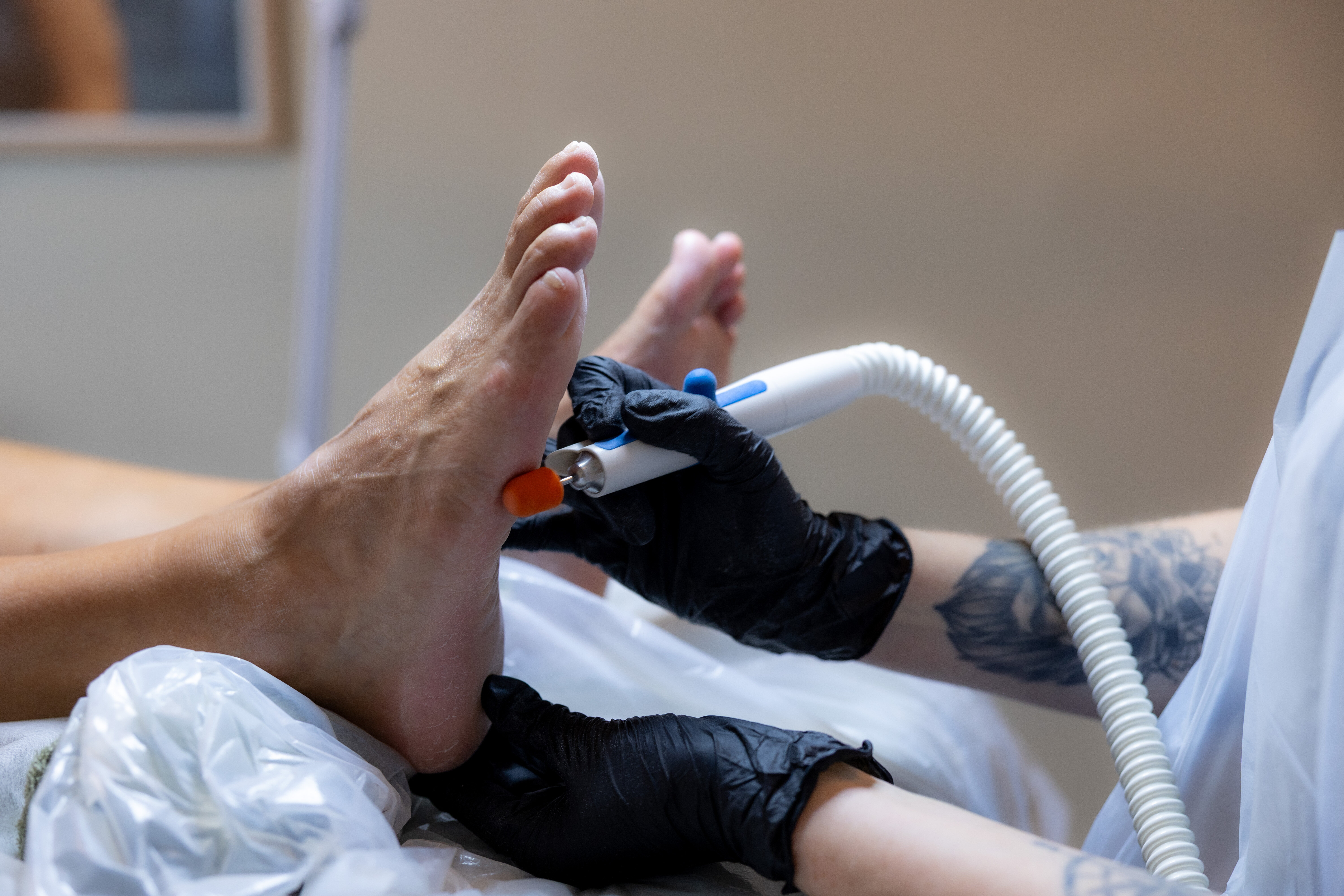 Bildet viser Vilja Norin Klausen som filer føtter.