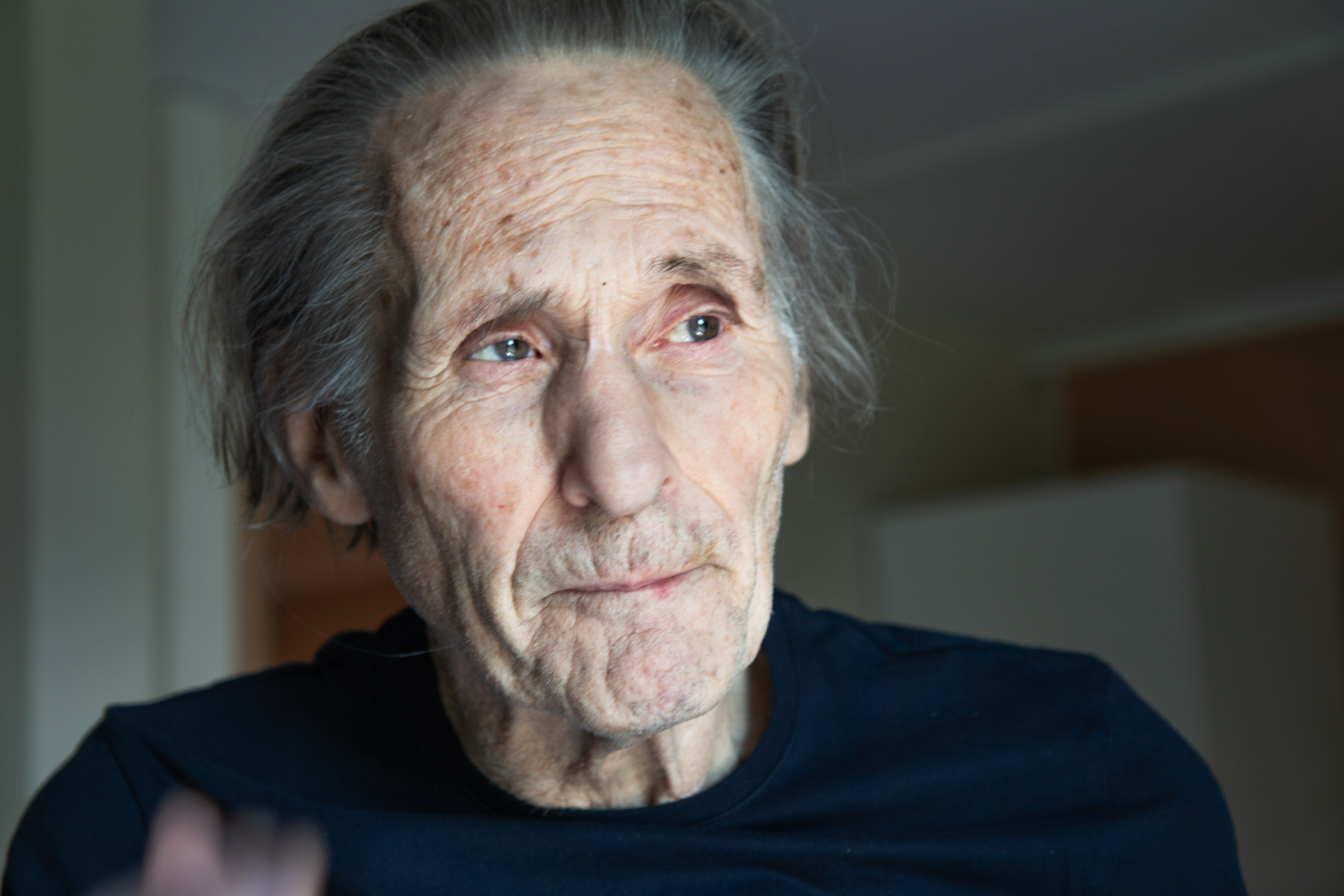 Bildet viser ansikt av pasient