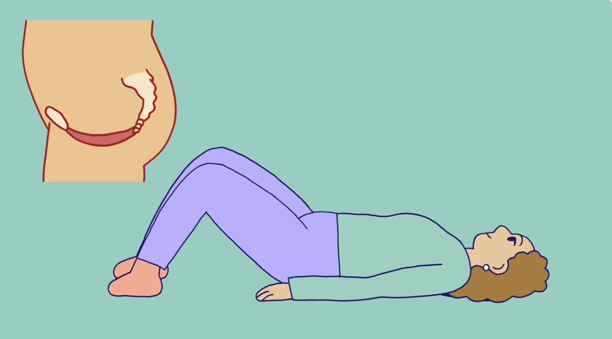 The illustration shows a woman’s pelvic floor, as well as a woman lying on the floor with her knees bent, ready for pelvic floor training.n viser en kvinnes bekkenbunn samt en dame som ligger på gulvet med bøyde knær, klar for bekkenbunnstrening