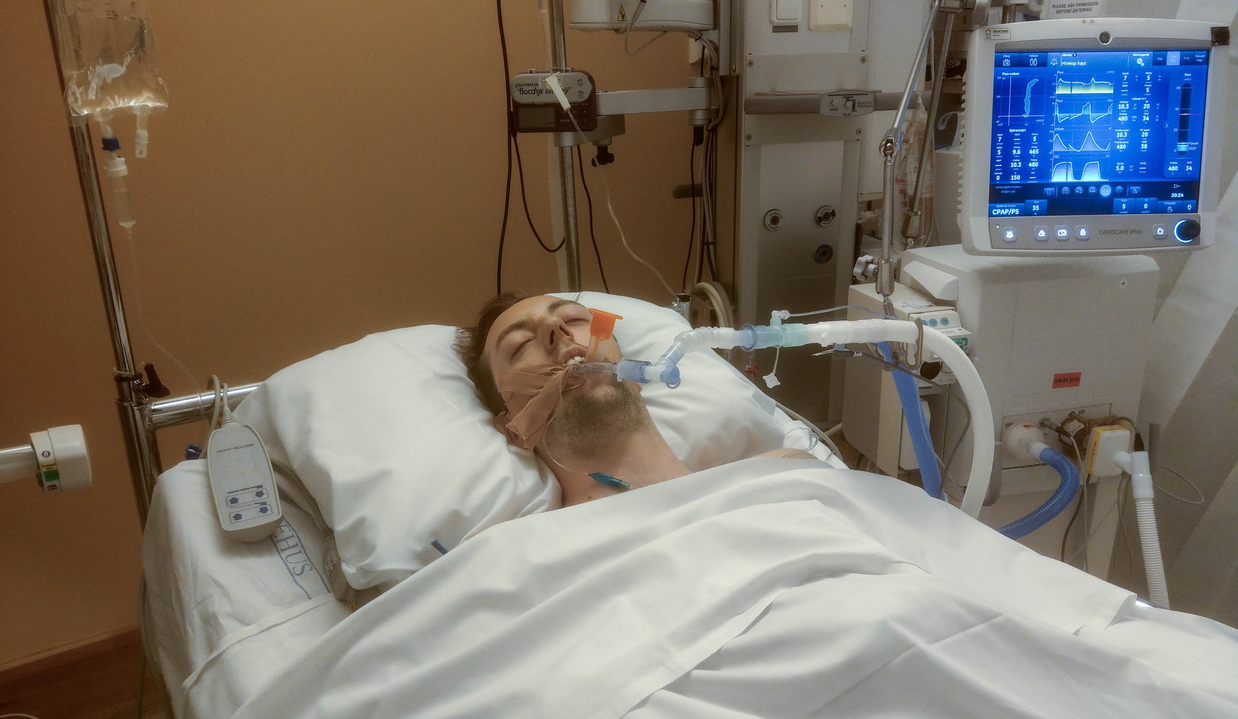 Bildet viser Nicholas Wilkinson på intensiv.