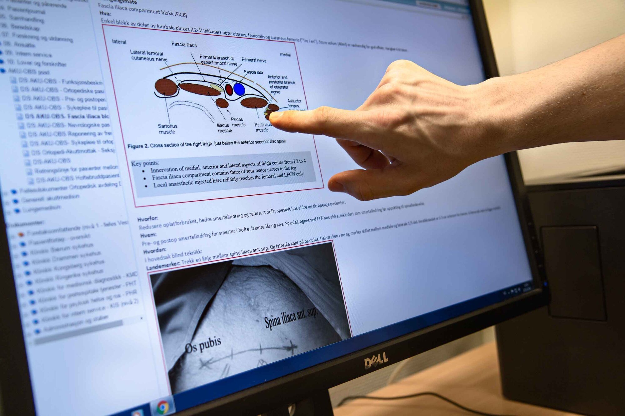 Hvordan sette blokade