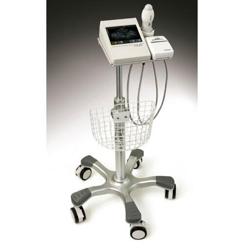 Bildet viser en blæreskanner