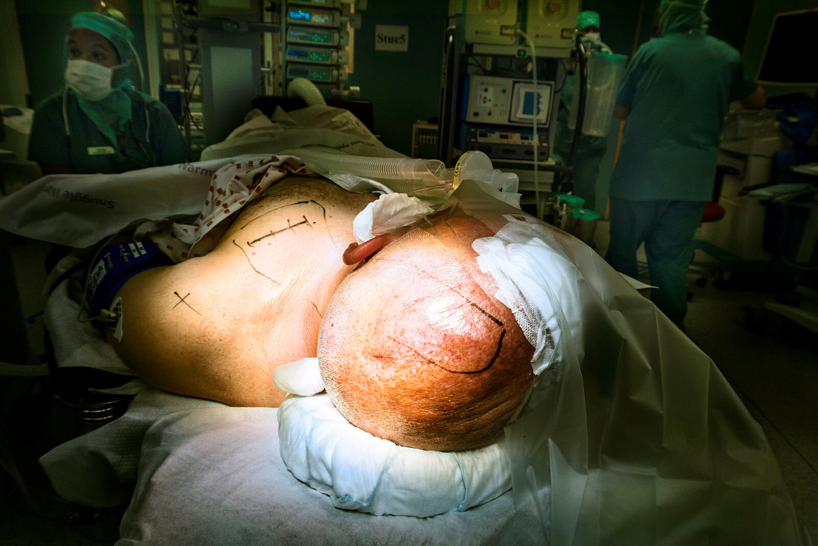 Parkinson-operasjon, Rikshospitalet