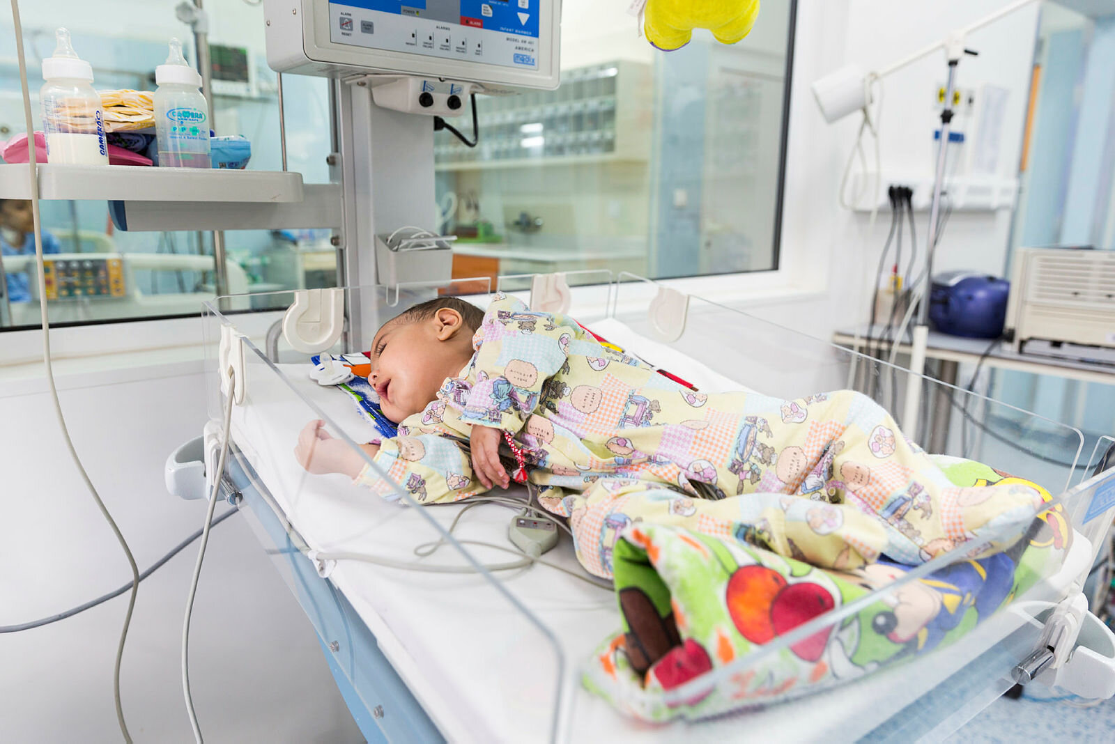 Bildet viser en baby med hjertefeil som ligger i kuvøse på sykehus