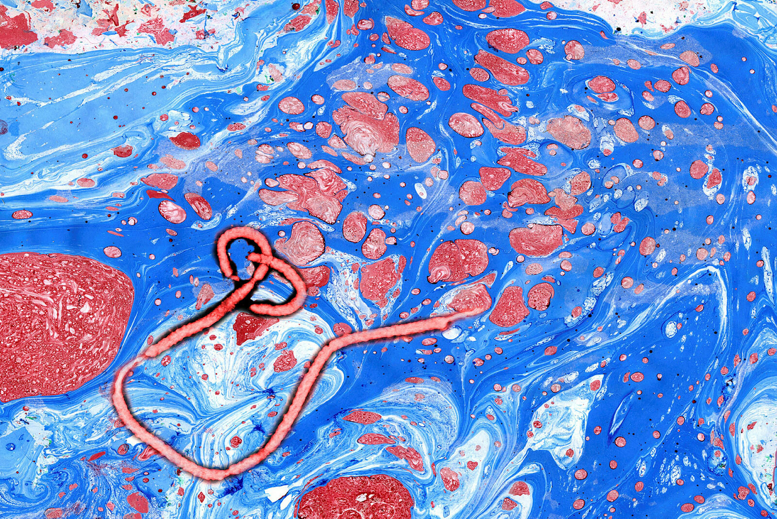 Bildet viser et ebolavirus