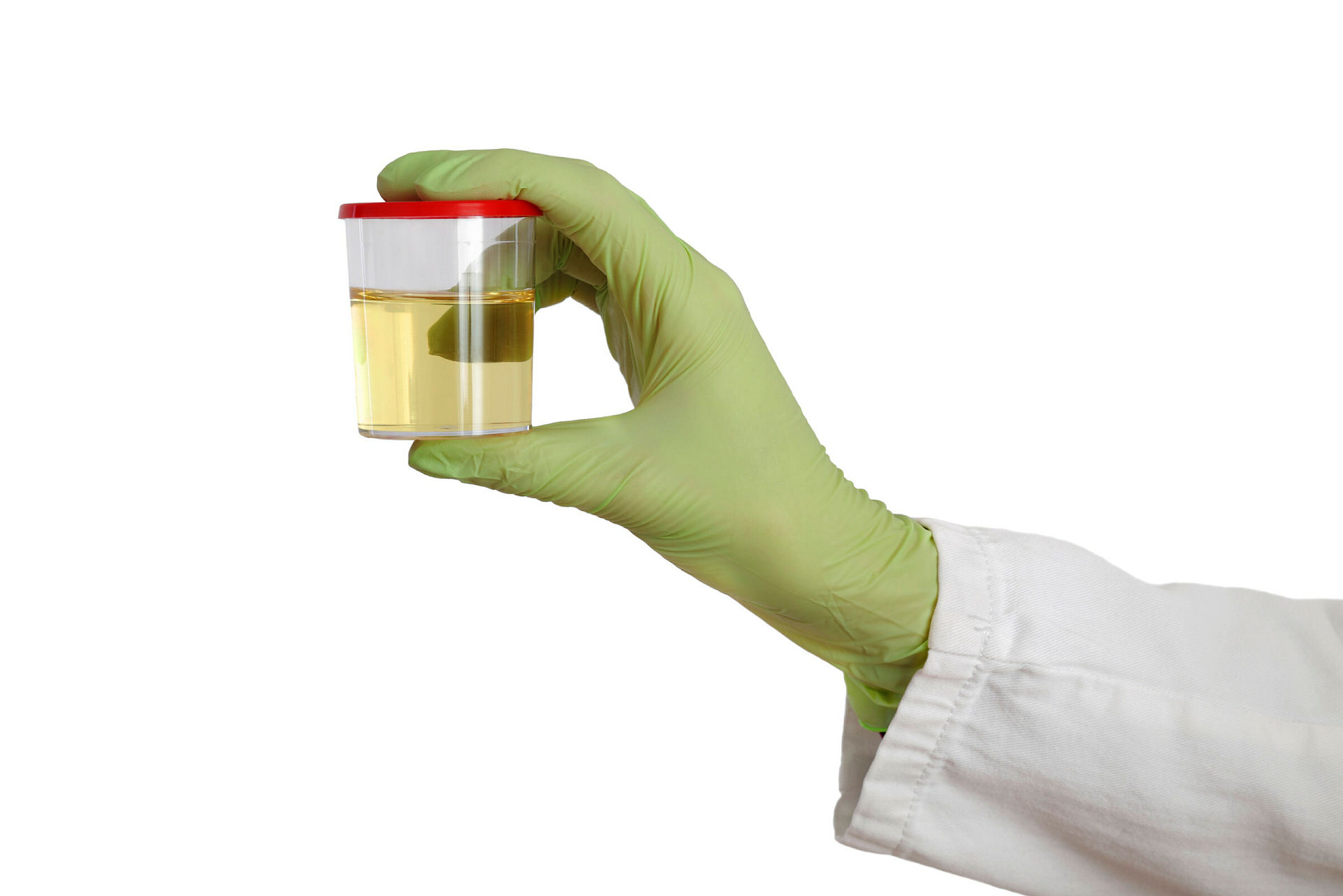 Hånd som holder et urinprøve glass