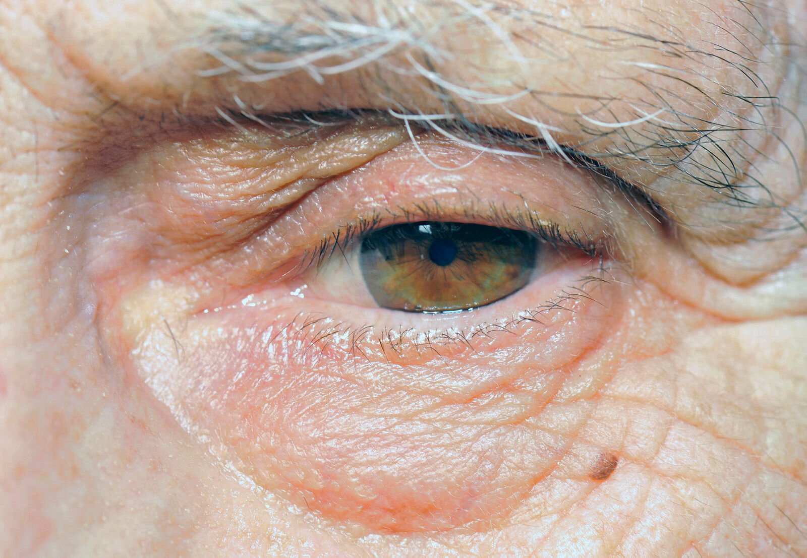 Illustrasjonsfoto: Mostphotos