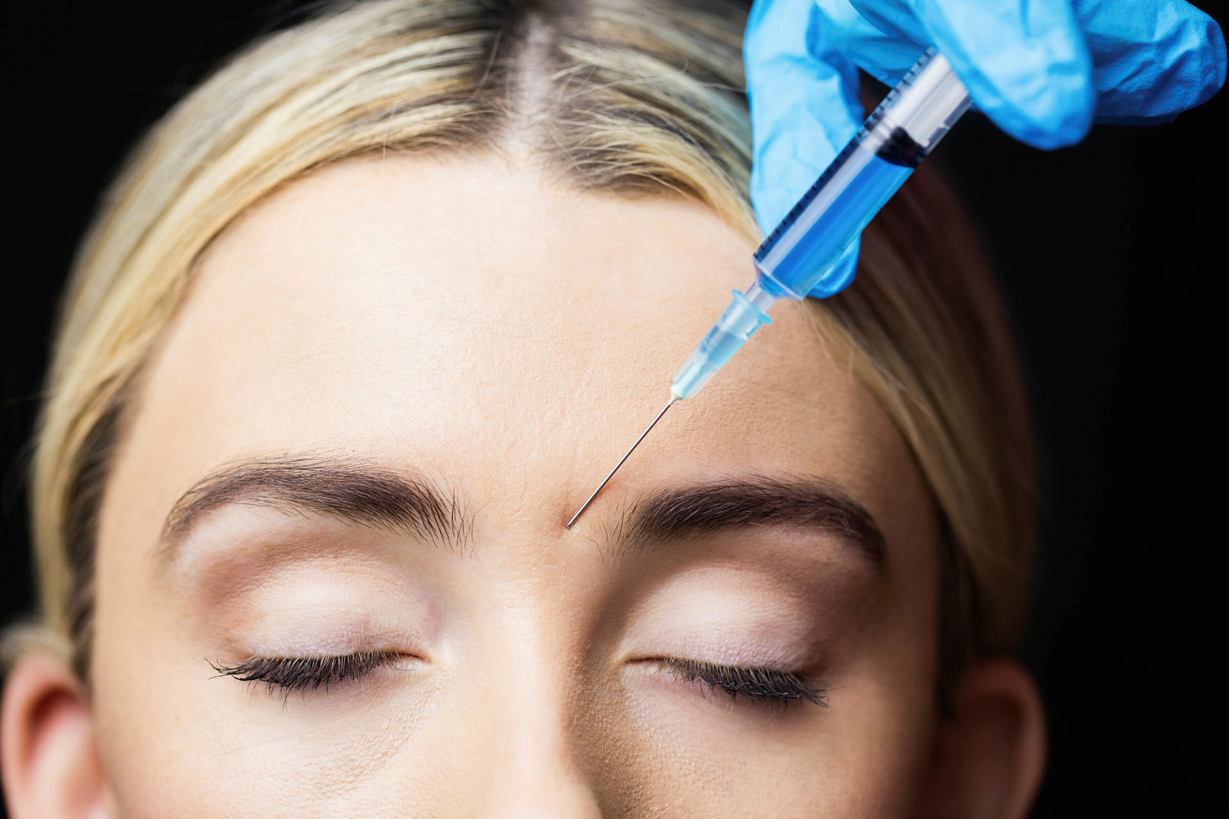 Woman receiving botox injection on her forehead in a examination room