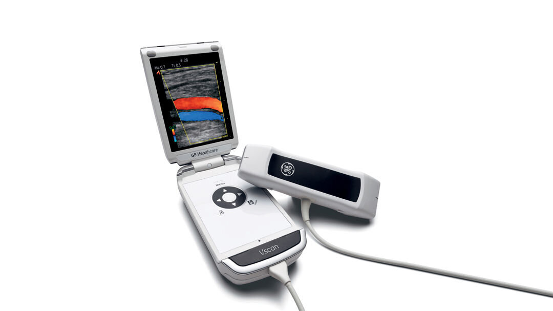 Bildet viser et håndholdt ultralydapparat: GE Healthcare’s Vscan with Dual Probe