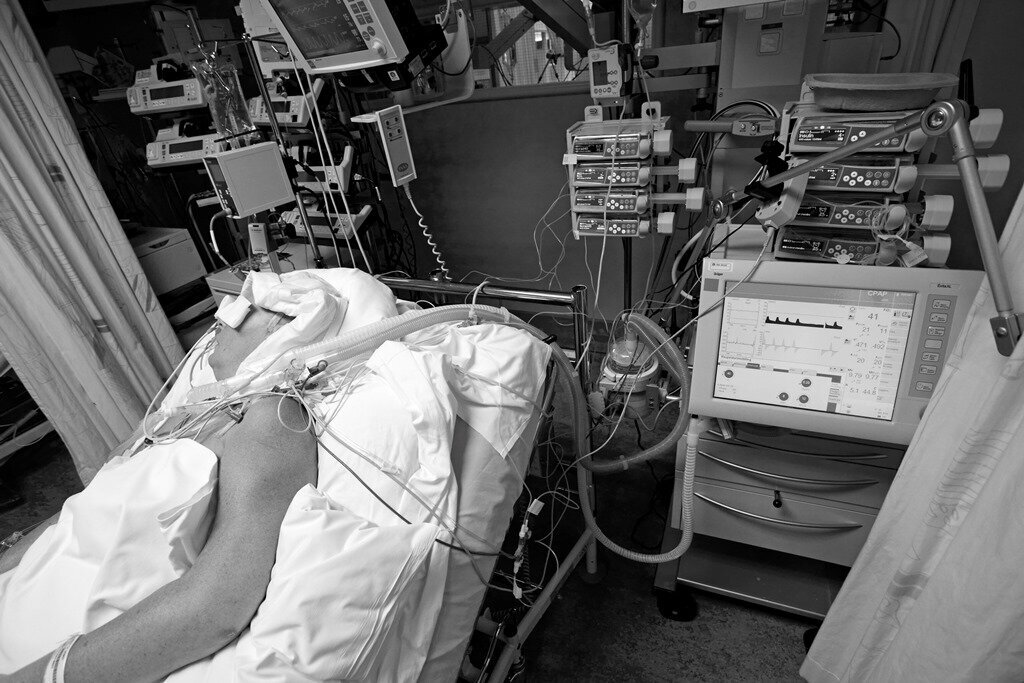 Pasient i respirator på intensivavdeling