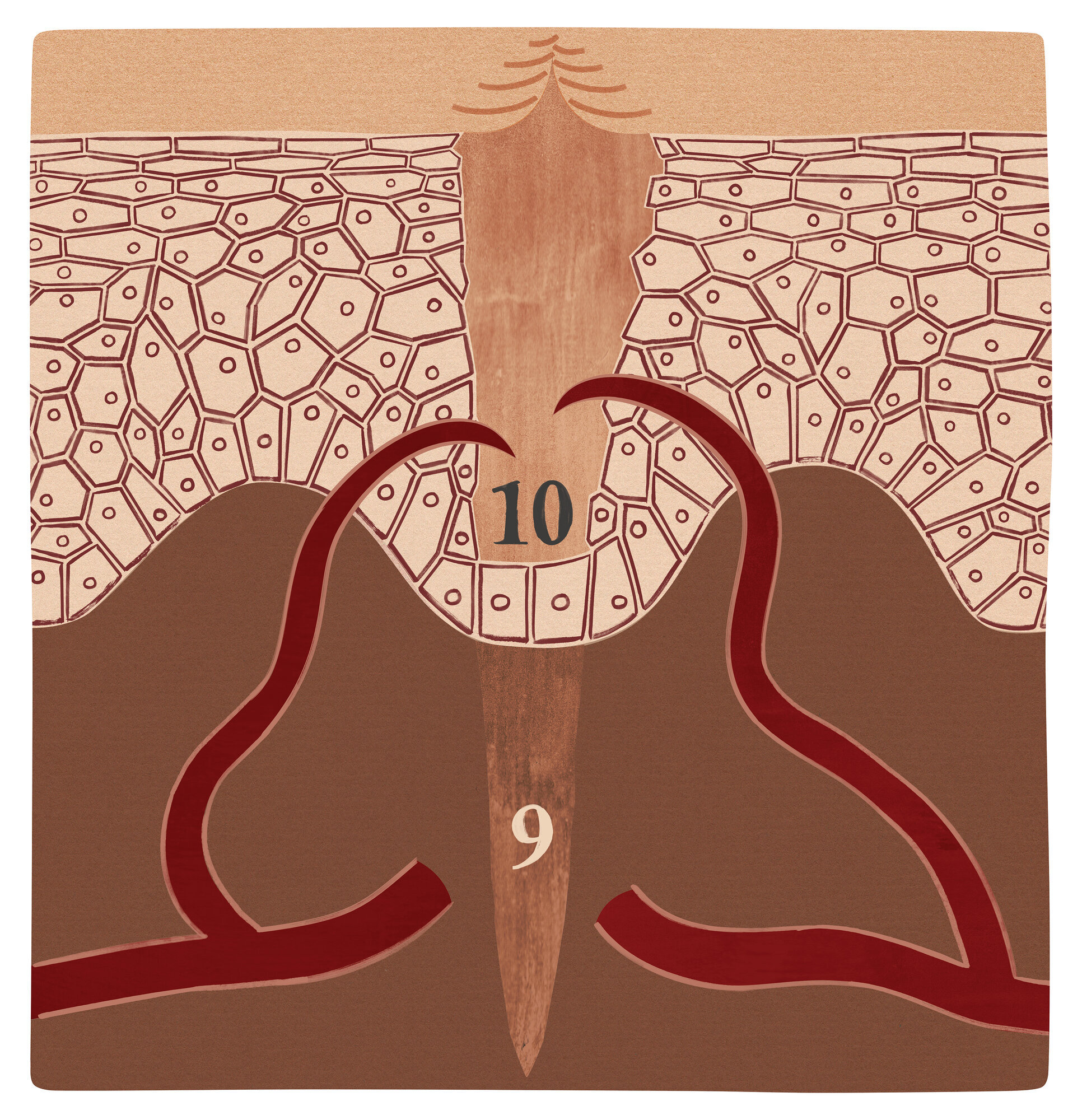 Illustrasjonen viser et sår i granulasjonsfasen