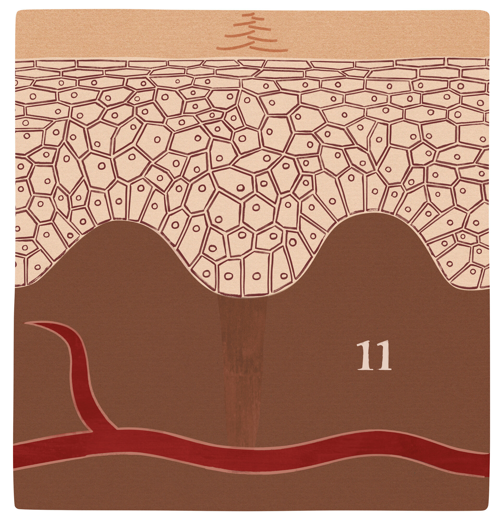Illustrasjonen viser et sår i modningsfasen