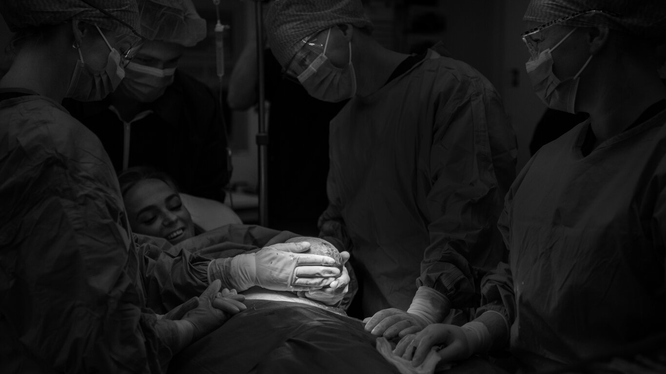 Bildet viser MAC-keisersnitt