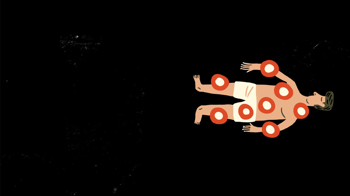 Illustrasjonen viser en kropp