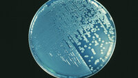 Pseudomonas aeruginosa, petriskål Bildet viser en petriskål med Pseudomonas aeruginosa.