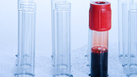 Bildet viser et blodprøveglass fylt med blod.