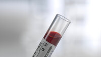 Bildet viser et blodprøveglass med blod i.