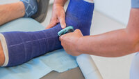 Bilde viser gipsing av bein