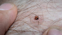 bilde av flåttbitt