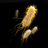 Bildet viser ESBL (extended-spectrum ­beta-lactamase).