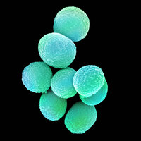 Bildet viser  MRSA (meticillin­resistente gule stafylokokker).