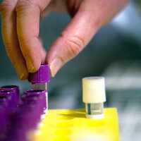 En person setter blodprøver i et stativ