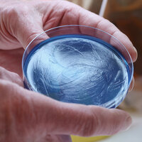 Bildet viser en petriskål med Pseudomonas aeruginosa.