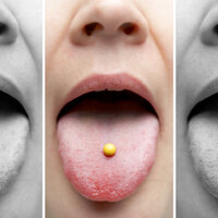 Bildet viser hormonelle prevensjonsmidler.