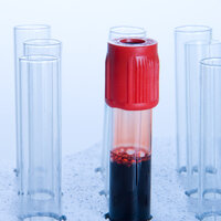 Bildet viser et blodprøveglass fylt med blod.