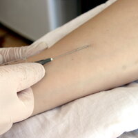 Bildet viser en hånd som legger inn nål i en arm.