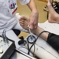 Bildet viser Aorta-screening 